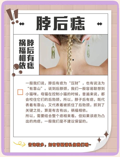 男人脖子后面痣相圖解