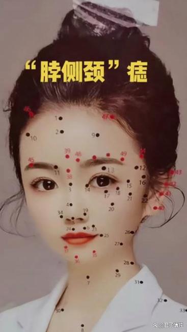 脖子痣的位置與命運(yùn)