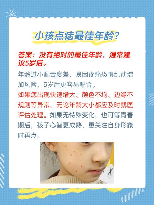 小孩有這三顆痣注定有出息