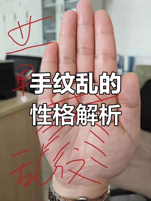 手紋亂的人命好嗎
