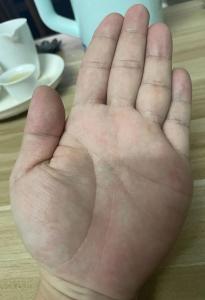 方形手的人如何