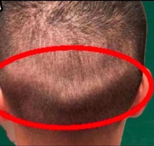 后腦勺反骨的命相氣質