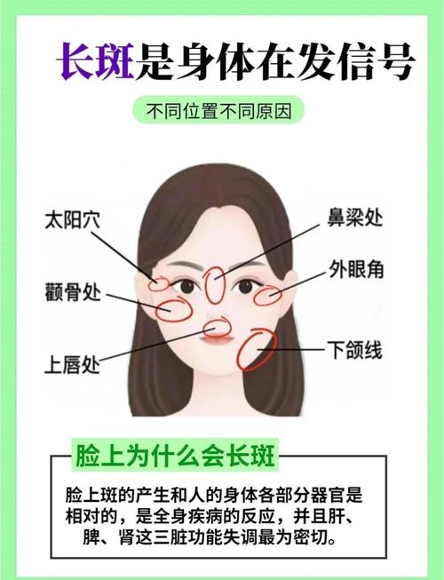 面相分析臉上多斑的女人面相