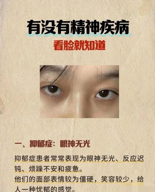 面相抑郁的人 容易患精神病的面相