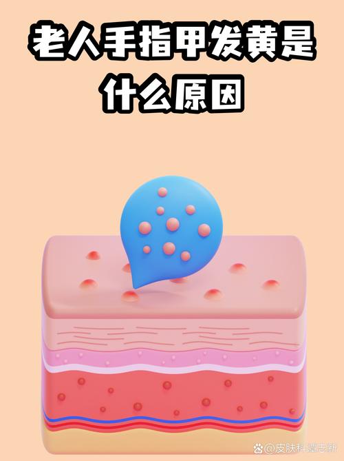 指甲顏色的變化預示著什么