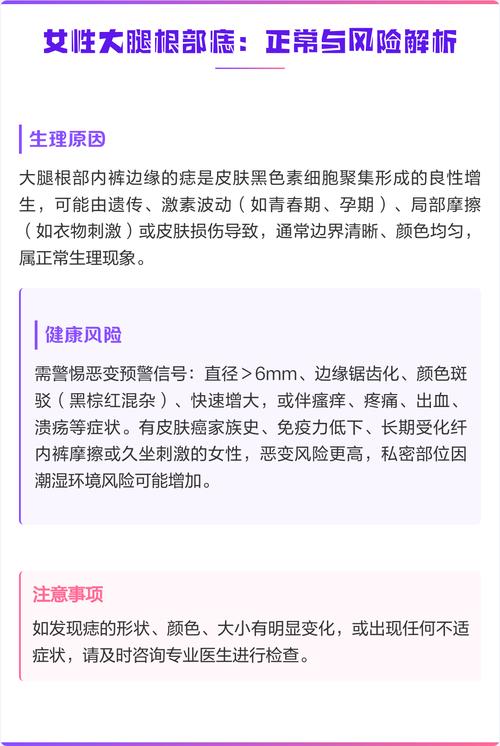 女人右大腿根有痣圖解 大腿根部痣圖解