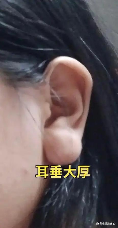 富貴耳朵是什么樣子 耳朵富貴相圖片