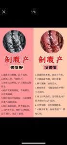 哪些剖腹產會影響人的運勢？
