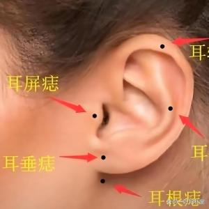 耳朵折富痣在哪 哪里長痣好運富貴
