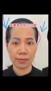 夫妻宮凹陷 晚婚很幸福