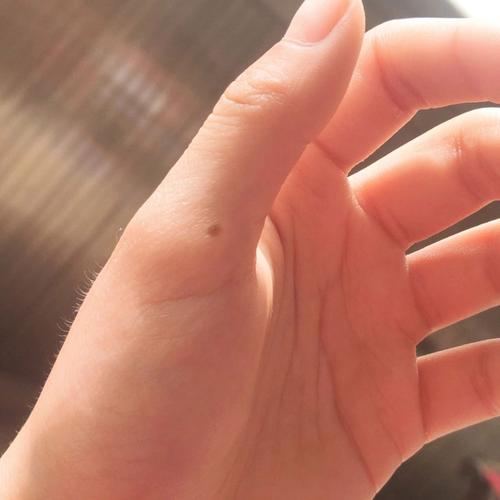 女人左手大拇指上有痣