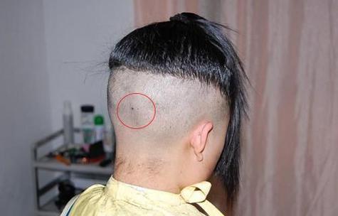 后腦勺長痣的人的運程