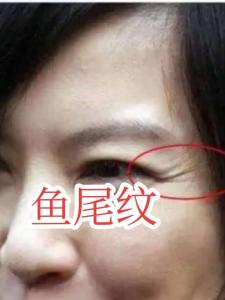女人魚尾紋面相如何 性格好不好