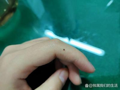 左手食指第一關節有痣