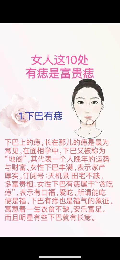 真正富貴之極三處痣 貴不可言