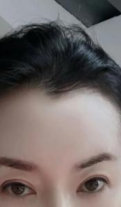 美人尖面相好不好 有什么講究