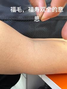 胳膊上長白毛的寓意是吉是兇