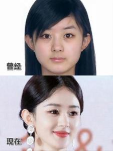 整容能改變?nèi)说拿嫦嗟芨淖內(nèi)说倪\勢嗎?(一)