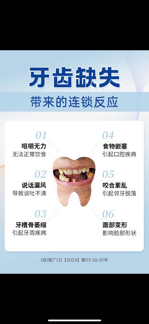 牙齒稀疏的人命運(yùn)好不好 有什么說(shuō)法