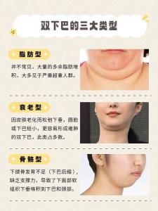 女人有雙下巴代表什么，女人雙下巴面相