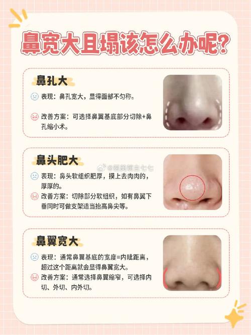 塌鼻子面相分析面相分析 鼻梁塌面相分析詳解