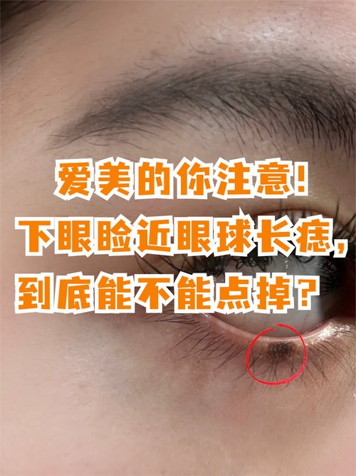 眼下痣好不好，眼下痣是克妻痣嗎