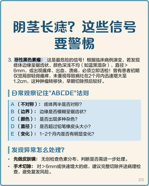 體相中龜頭有痣寓意什么