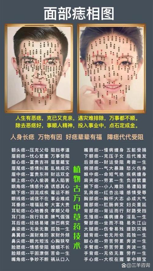 頭上長瘊子算命說法