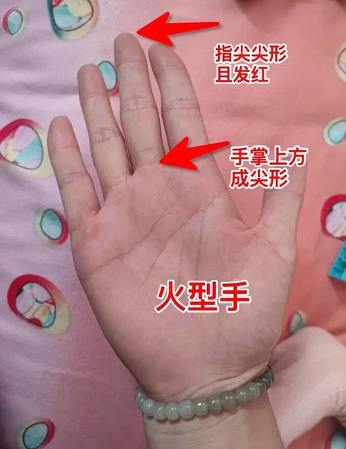 燃燒著溫馨愛苗的手相