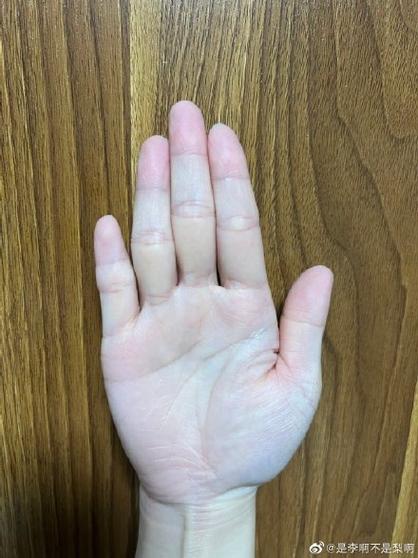 小指長的人緣差
