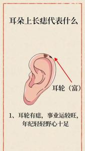 外耳輪有痣代表了什么呢