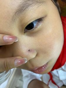 小孩右眉毛長痣運勢好不好