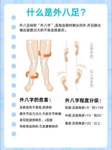 男的走路八字腳的命
