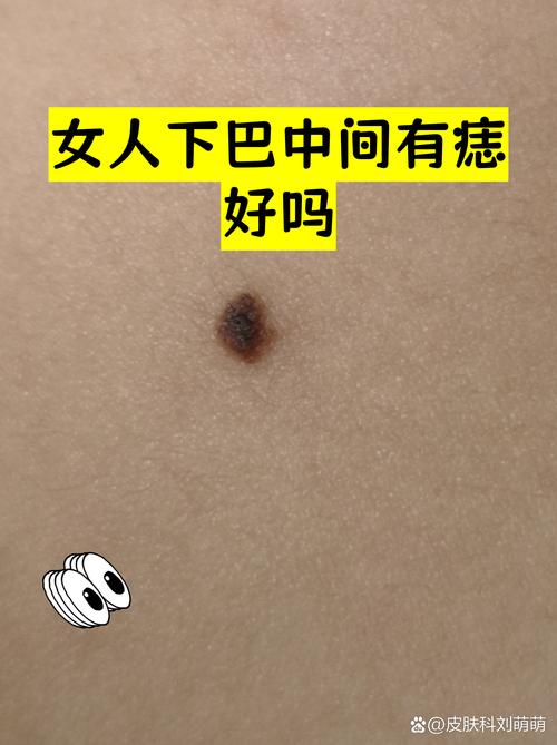 下巴正中間有痣