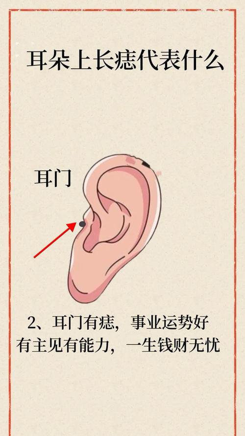 耳朵附近長痣