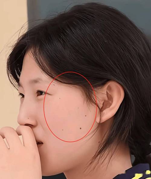 右臉腮幫下有痣