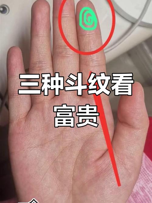 女人六個斗形紋 運勢極好但多愁善感