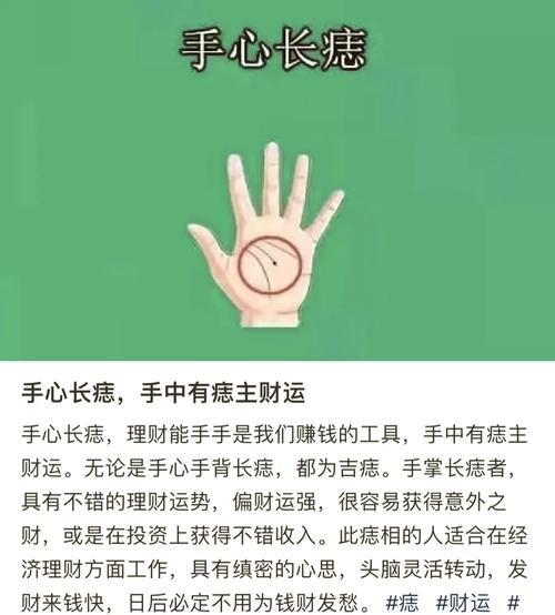 女人左手痣相最準圖 事業輝煌騰達