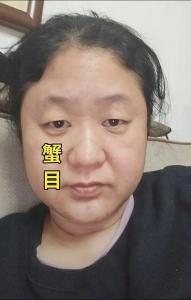 有蟹眼的人面相分析