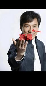 什么是獅鼻